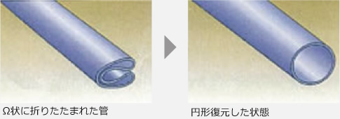 Ω状に折りたたまれた管→円形復元した状態